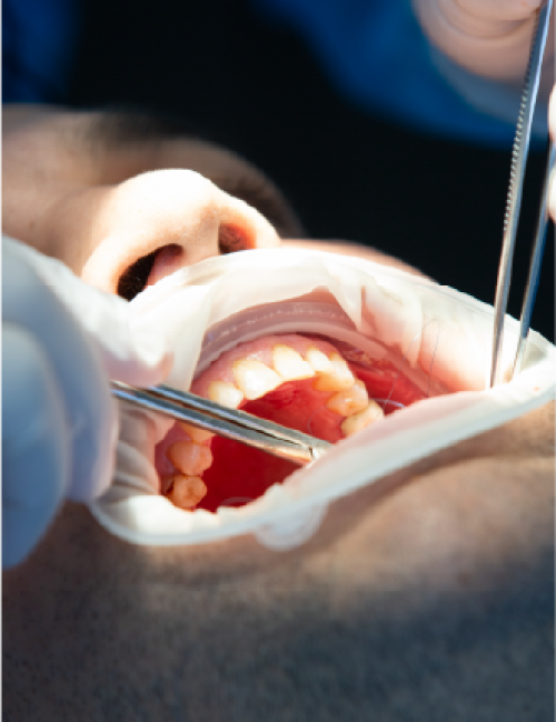 clinica dental corrales cirugia