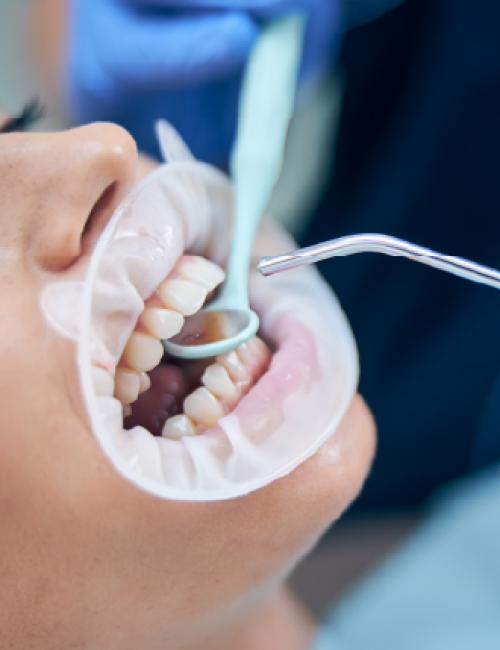 clinica dental corrales conservadora