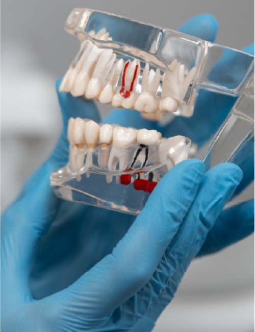 clinica dental corrales endodoncia