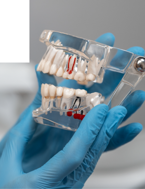 clinica dental corrales endodoncia_1@2x