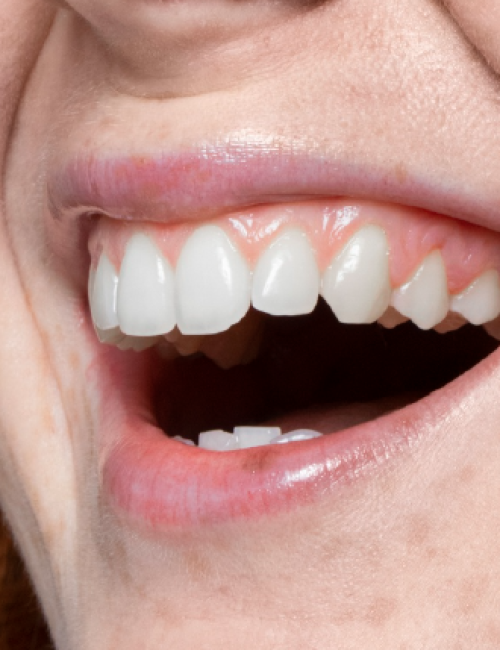 clinica dental corrales periodoncia