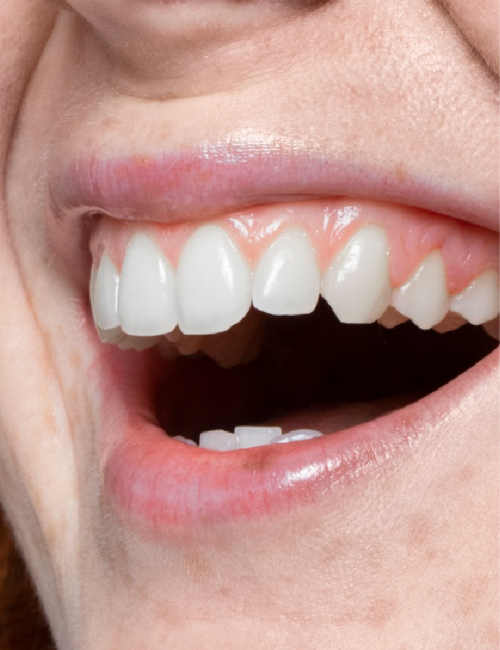 clinica dental corrales periodoncia@2x